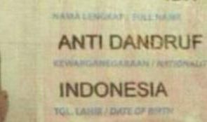 6. Anti Dandruf