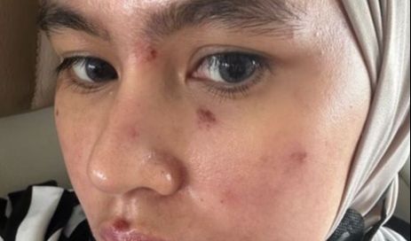 1. Kelainan Kulit dan Gejala yang Muncul