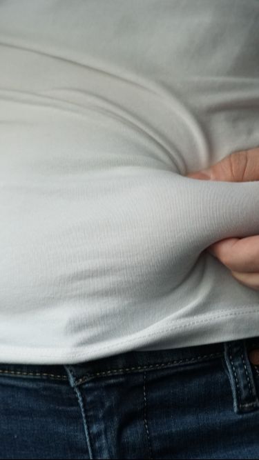 Kurus Tapi Buncit, Ternyata Ini Penyebab dan Cara Mengatasinya!