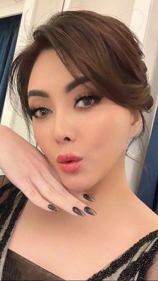 Usai menjalani perawatan tersebut, wajah Dhena terlihat lebih tirus.