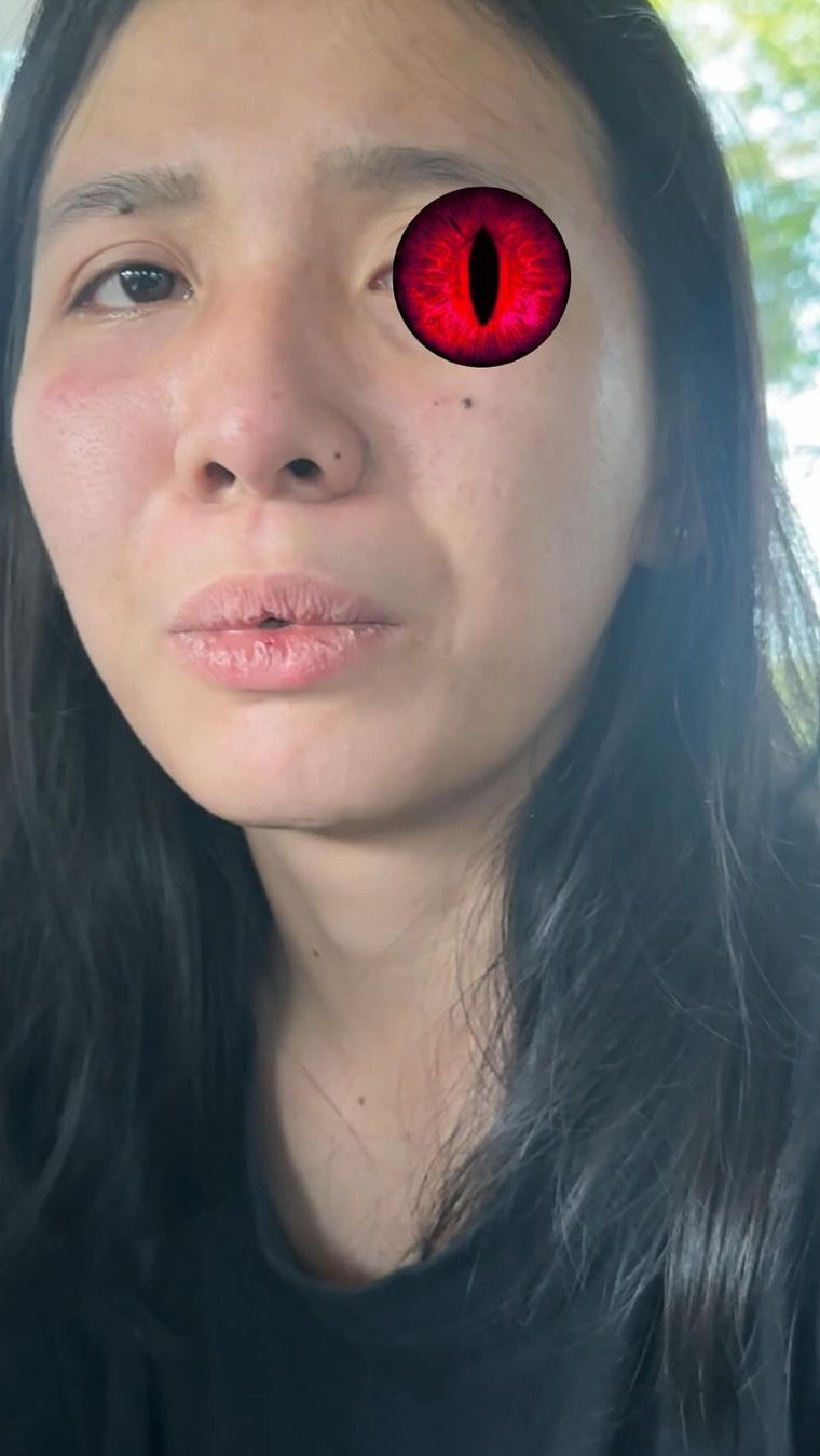Terungkap Motif Pengasuh Aniaya Anak Aghnia Punjabi hingga Lebam, Jengkel Korban Tak Mau Diobati