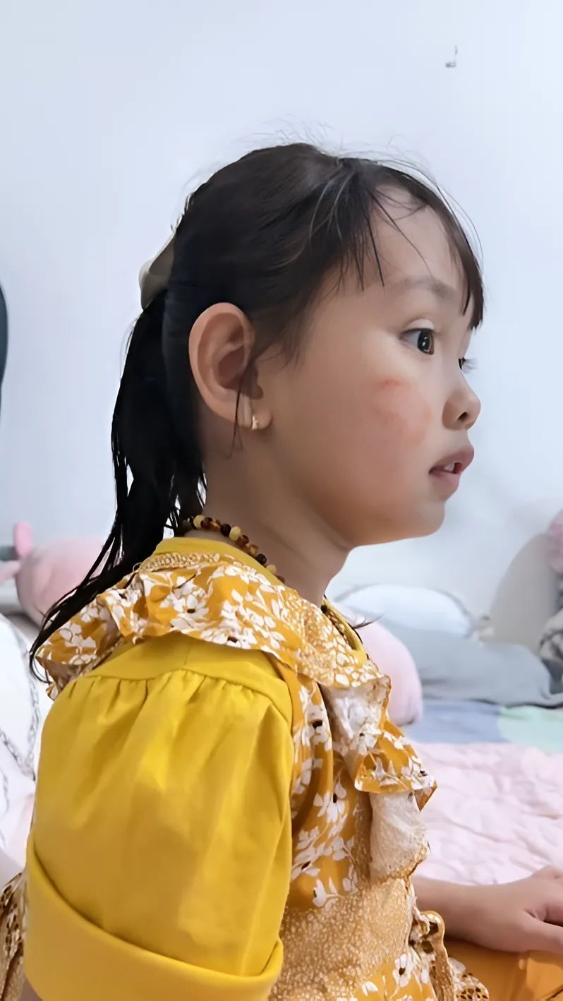 Pipi Bocah Tampak Lebam Sampai Ayah Panik, Saat Ditanya Malah Bikin Ngakak