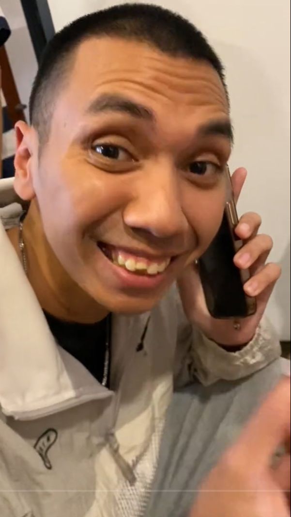 Rayi RAN Curhat Giginya Patah Saat Makan, Netizen: Masih Ketolong Sama Wajah Tampan