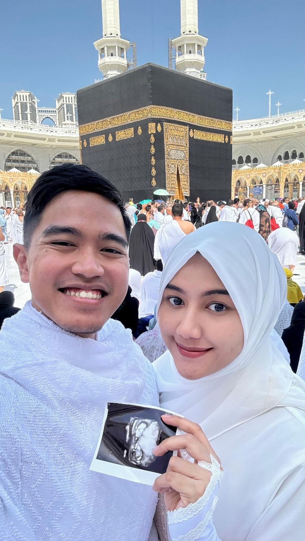 Kaesang Pangarep dan Erina Gudono tampak berbahagia usai mengumumkan kehamilan buah hati pertama mereka