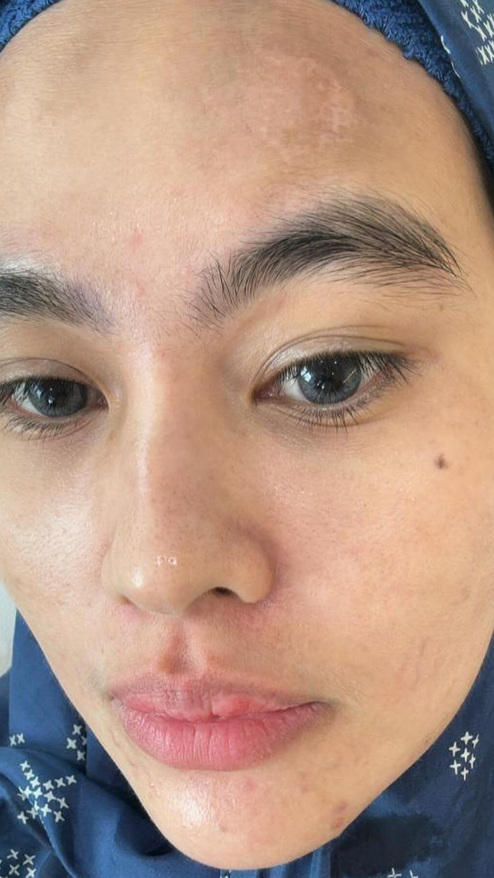 Kemudian di slide berikutnya ia kembali membagikan wajahnya tanpa filter dan makeup