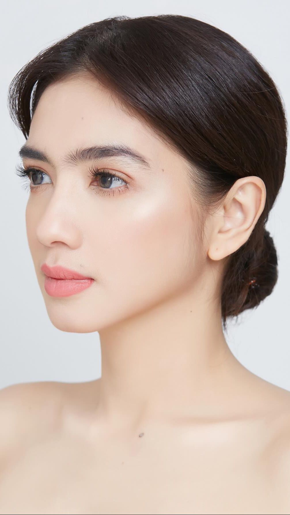 Ini foto sebelum operasi. Banyak yang bilang kalau Angel sudah cantik banget walau tanpa operasi.
