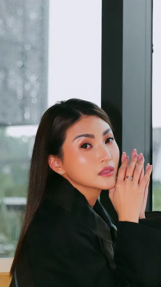Usai Digugat Cerai Ruben Onsu, Sarwendah Pilih Percantik Diri dengan Operasi Plastik di Korea Selatan