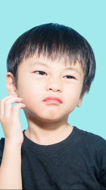 Anak Alergi Susu Sapi, Pastikan Konsul Dokter Biar Tumbuh Kembangnya Tak Terhambat