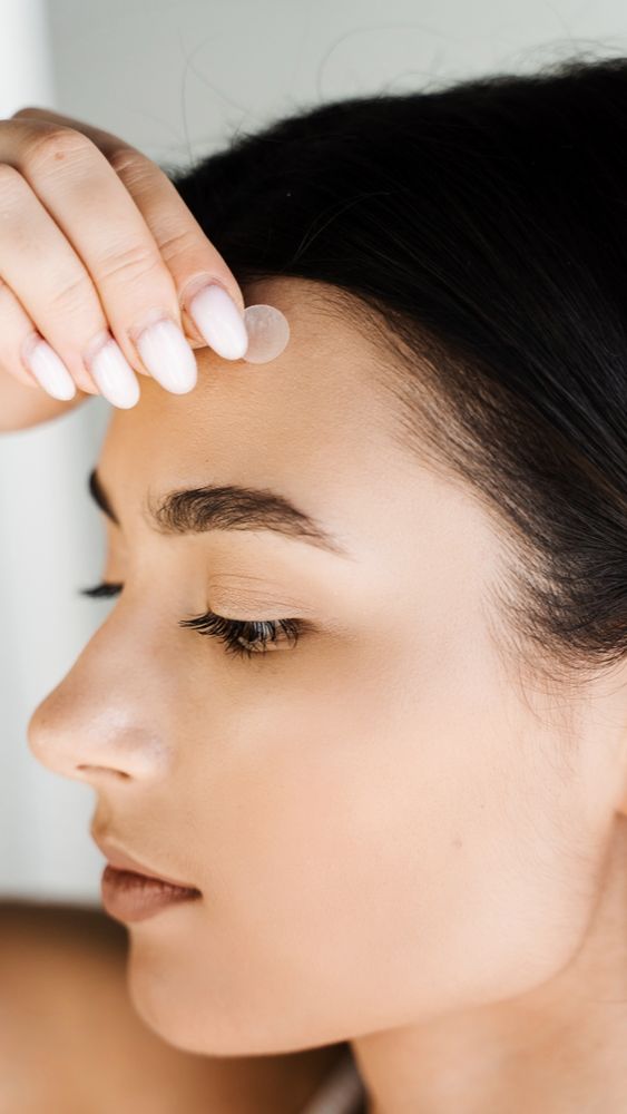 Panduan Memilih Acne Patch Tepat Sesuai Jenis Jerawat, Biar Tak Salah Beli