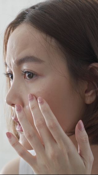 Kenalan dengan Teknologi Microbiome yang Bikin Jerawat Tak Kambuh Lagi