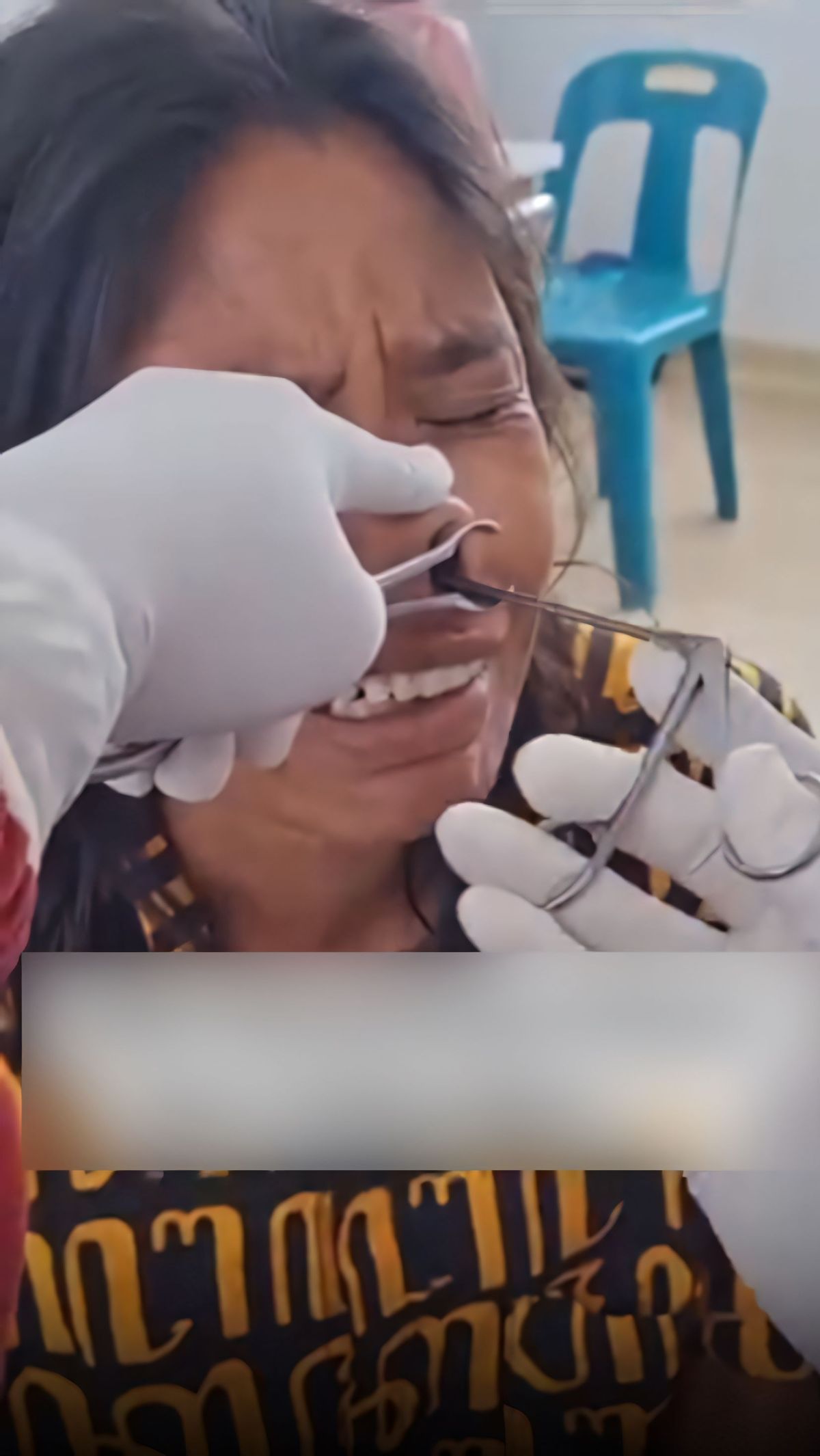 Mengeluh Sakit Hidung 2 Minggu, Pas Periksa Ternyata Benda Asing Hidup di Dalamnya