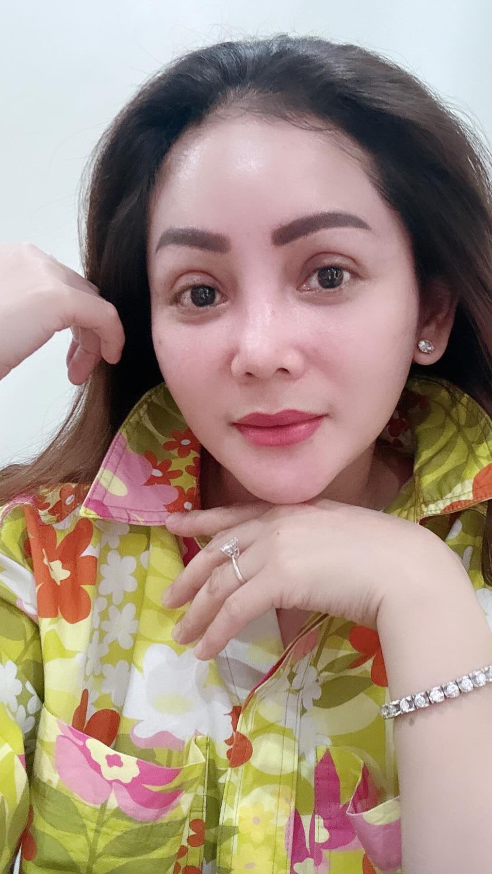 Terlebih di bagian hidung dan mata. Pasalnya, area hidung Kristina miring sehingga harus diperbaiki.