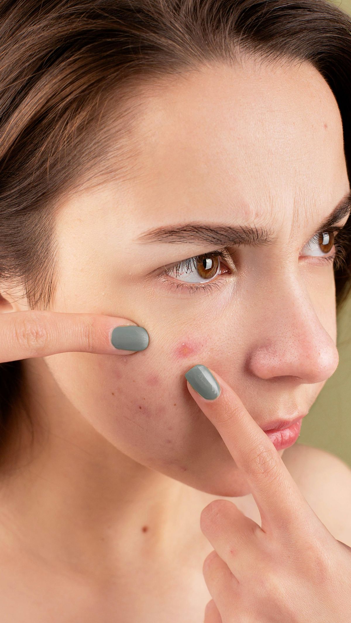 Doa Menghilangkan Jerawat dan Bisul, Acne Fighter Wajib Tahu!