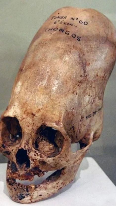 Misteri Penemuan Tengkorak Lonjong di Peru Terpecahkan, Ternyata Bukan Alien