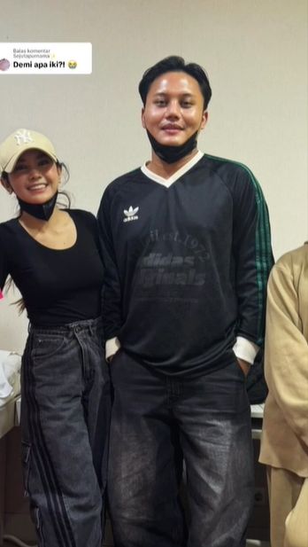 Beginilah potret Rizky Febian dan Mahalini yang diduga setela oplas hidung.