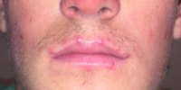 di bibir