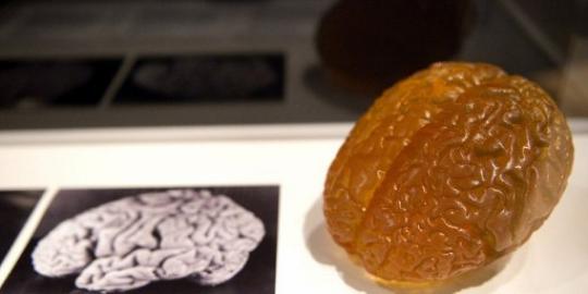 Pameran koleksi otak di London