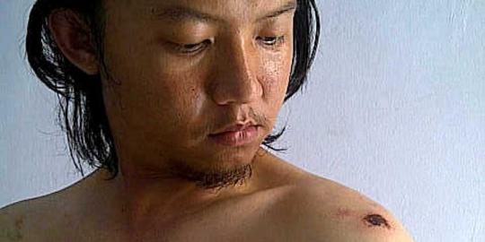Hasil lab UI, cairan kimia dipastikan asam sulfat