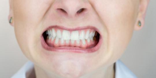 Bruxism: Kebiasaan menggeretakkan gigi saat tidur