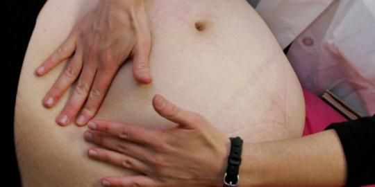 Obesitas saat kehamilan akan lahirkan anak autis?