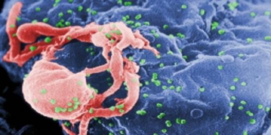 Ilmuwan temukan sel pembasmi virus HIV/AIDS?