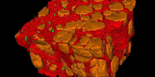 Gambar 3D dari jaringan mampu mendeteksi dan mengobati kanker