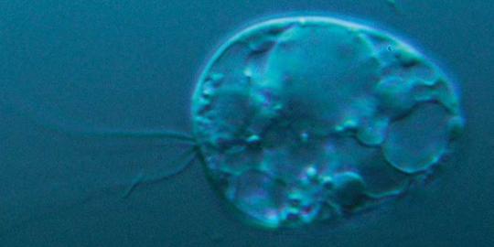 Ilmuwan temukan Collodictyon \'makhluk tertua\' di bumi
