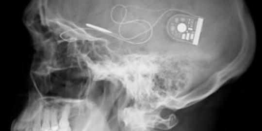 Akhirnya orang buta bisa melihat indahnya dunia lagi