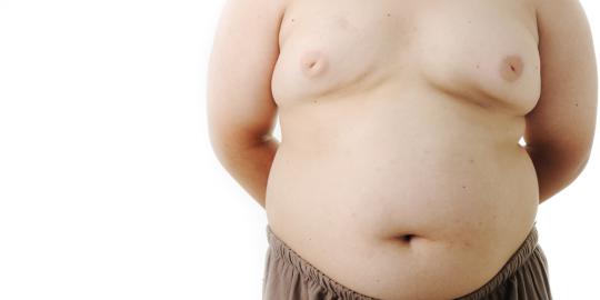 Awas, anak obesitas berisiko terkena kanker kandung kemih!
