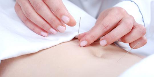 Akupunktur terbukti ampuh redakan nyeri kronis pasien