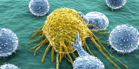 Peneliti temukan sebab penyebaran kanker lambung