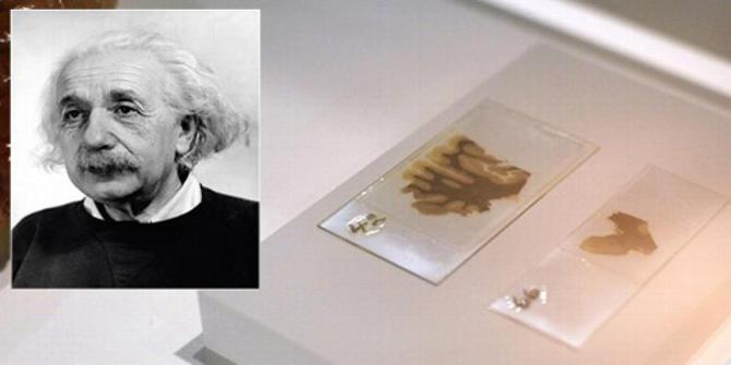 Otak Albert Einstein berbeda dari manusia pada umumnya 