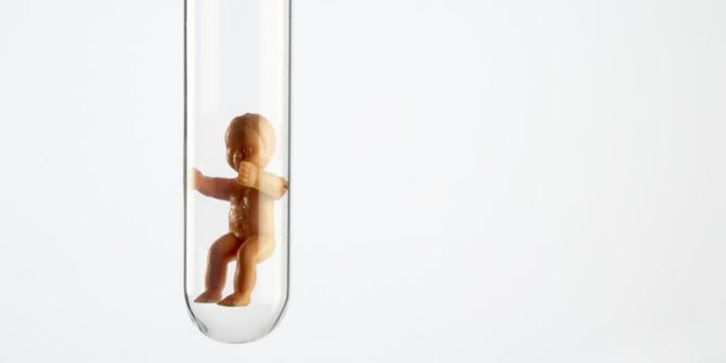 Bayi tabung kembar membahayakan kesehatan ibu? | merdeka.com
