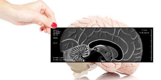 6 Fakta yang harus diketahui tentang gegar otak