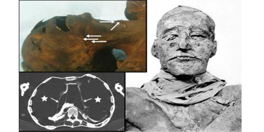 Pharaoh Ramesses III mati dengan leher tersayat