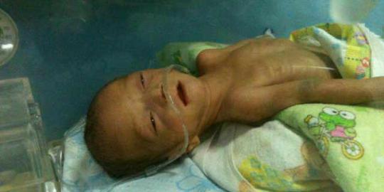 Tragedi bayi Dera, baru pejabat gerak benahi pelayanan kesehatan