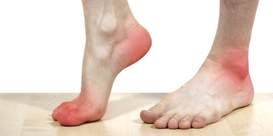 Penanganan diabetes lambat sebabkan amputasi kaki