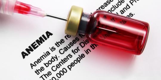 10 Gejala anemia yang perlu diwaspadai