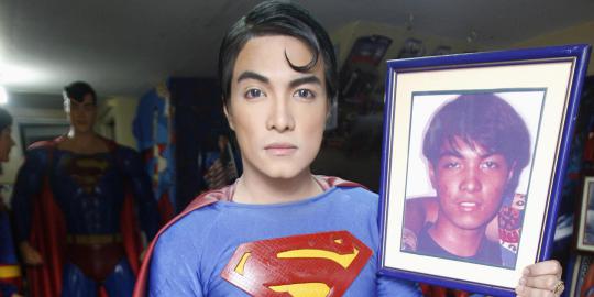 Pria ini rela operasi plastik wajahnya mirip Superman