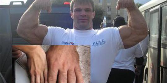 Lelaki Rusia mirip raksasa Hulk