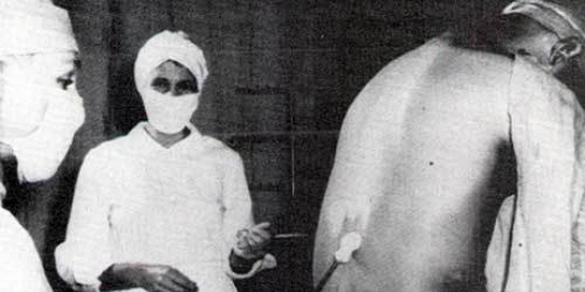 pada kulit hitam rev1