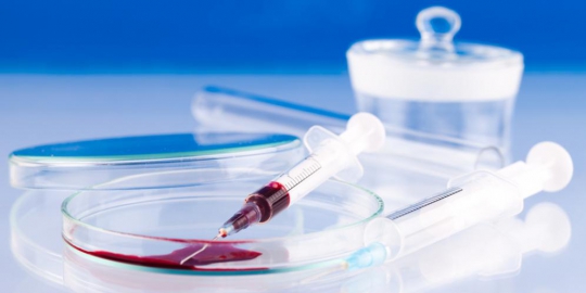 melakukan tes herpes rev1