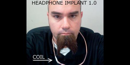 Pria ini menanam headphone di telinganya