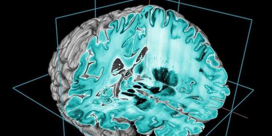 Ilmuwan tampilkan otak manusia dalam gambar 3D resolusi tinggi