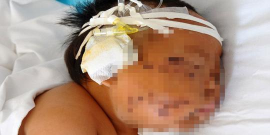Digigit saat menyusui, ibu di China tusuk bayinya 90 kali