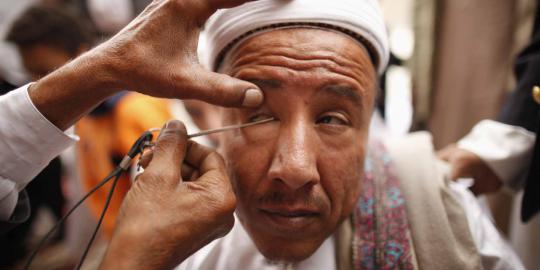 Menengok tradisi unik Mesir kuno membersihkan mata dari penyakit