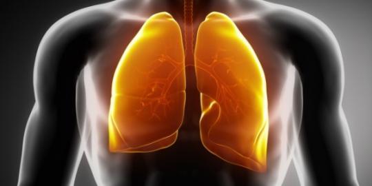 Perokok harus rutin jalani tes kanker paru-paru?