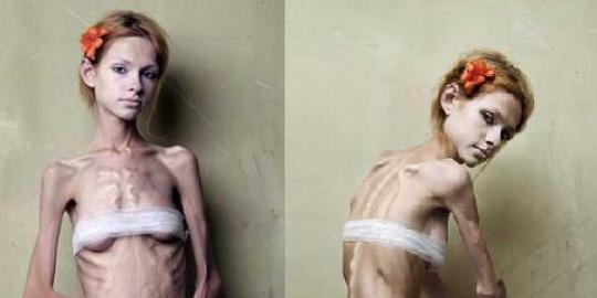 5 Kebiasaan penderita anoreksia