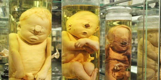 7 museum paling unik di amsterdam