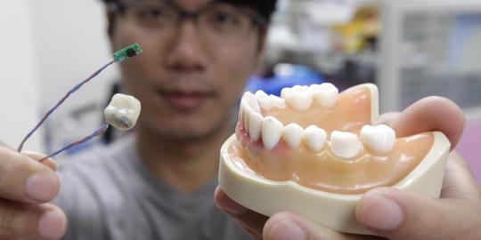 Smart Tooth, gigi palsu pendeteksi kesehatan di dalam mulut